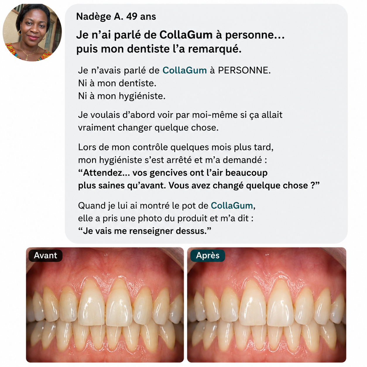 CollaGum™ — Des gencives plus saines chaque jour