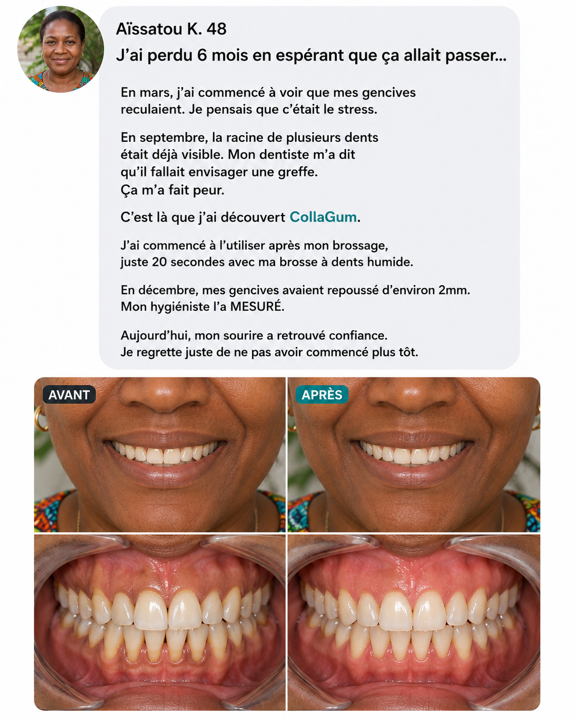 CollaGum™ — Des gencives plus saines chaque jour