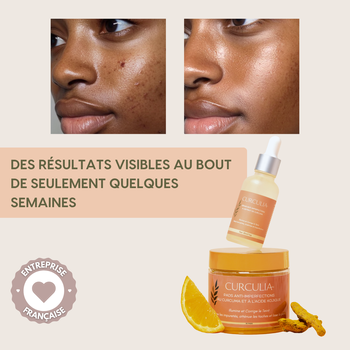 KURMEA+™ Pads anti-imperfections au Curcuma et à l’Acide Kojique