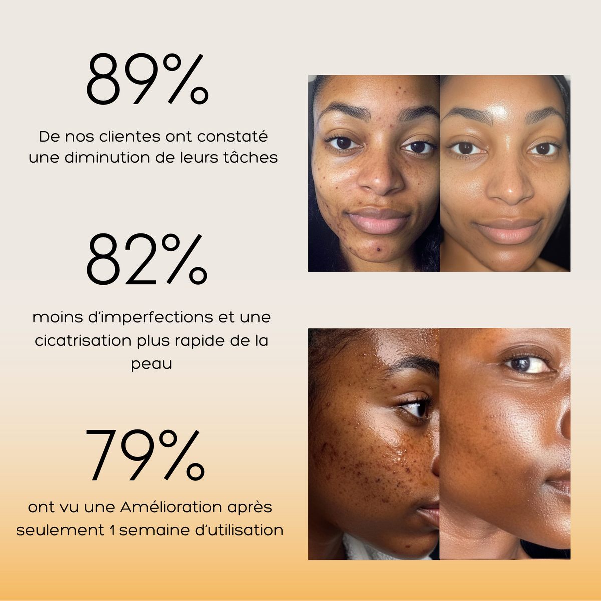 KURMEA+™ Pads anti-imperfections au Curcuma et à l’Acide Kojique